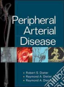 Peripheral Arterial Disease libro di Dieter R. S. (cur.); Dieter R. A. (cur.)