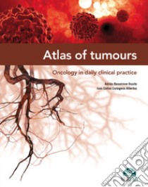 Atlas of tumours. Oncology in daily clinical practice libro di Romairone Duarte Adrián; Cartagena Albertus Juan Carlos