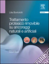 Trattamento protesico rimovibile su ancoraggi naturali e artificiali libro di Bortolotti Lilia