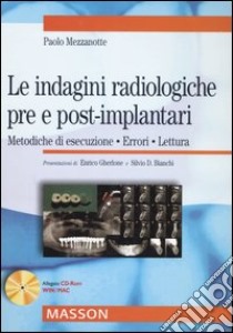 Le indagini radiologiche pre e post-implantari. Metodiche di esecuzione. Errori. Lettura libro di Mezzanotte Paolo