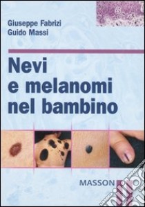 Nevi e melanomi nel bambino libro di Fabrizi Giuseppe - Massi Guido