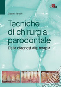 Tecniche di chirurgia parodontale. Dalla diagnosi alla terapia libro di Tarquini Giacomo