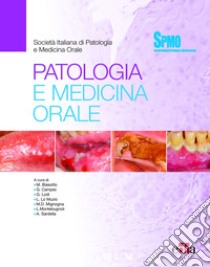 Patologia e medicina Orale libro di Biasotto M. (cur.); Lo Muzio L. (cur.); Mignogna M. D. (cur.)