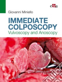 Immediate colposcopy. Vulvoscopy and anoscopy libro di Miniello Giovanni