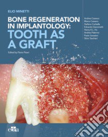 Bone regeneration in implantology: tooth as a graft libro di Minetti Elio