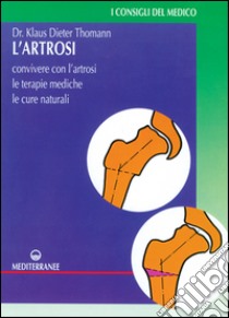 L'artrosi. Come convivere con l'artrosi. Le terapie mediche, le cure individuali libro di Thomann Klaus-Dieter