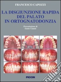 La disgiunzione rapida del palato in ortognatodonzia libro di Capozzi Francesco