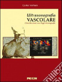 Ultrasonografia vascolare. Correlazioni con angiotomografia libro di Ventura Carlos