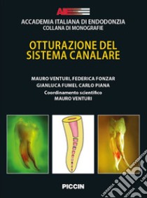 Otturazione del sistema canalare libro di Venturi Mauro; Fonzar Federica; Fumei Gianluca