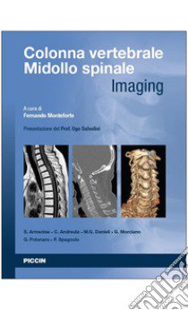 Colonna vertebrale. Midollo spinale. Imaging libro di Monteforte F. (cur.)