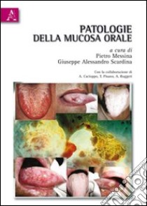 Patologie della mucosa orale libro di Messina Pietro; Scardina Giuseppe A.