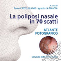 La poliposi nasale in 70 scatti. Atlante fotografico. Ediz. illustrata libro di Castelnuovo P. (cur.); La Mantia I. (cur.)