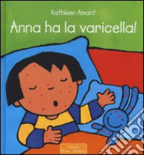 Anna ha la varicella! Ediz. illustrata libro di Amant Kathleen