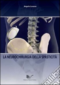 La neurochirurgia della spasticità libro di Lavano Angelo