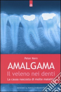 Amalgama. Il veleno nei denti. La causa nascosta di molte malattie libro di Kern Peter