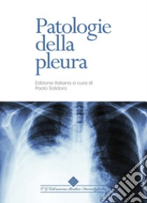 Patologie della pleura libro di Rahman N. M. (cur.); Hunt I. (cur.); Gleeson F. V. (cur.)