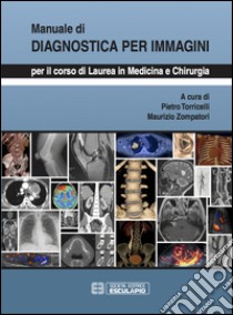 Manuale di diagnostica per immagini. Per il corso di laurea di medicina e chirurgia libro di Torricelli Pietro; Zompatori Maurizio