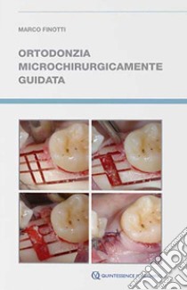 Ortodonzia microchirurgicamente guidata libro di Finotti Marco