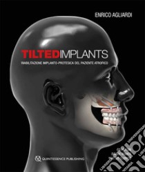 Tilted implants. Riabilitazione implanto-protesica del paziente atrofico libro di Agliardi Enrico; Romeo Davide; Clericò Matteo