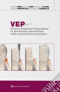 VEP. Vertical edgeless preparation: la dominanza parodontale nella preparazione protesica libro di Foce Edoardo; Noè Gaetano; Di Febo Gianfranco