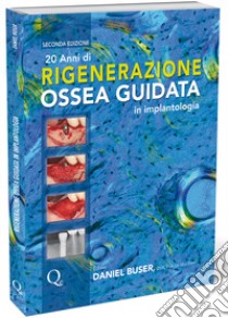 20 anni di rigenerazione ossea guidata in implantologia libro di Buser Daniel