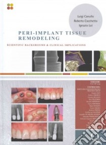 Peri-implant tissue remodeling. Scientific background and clinical implications libro di Canullo Luigi; Cocchetto Roberto; Loi Ignazio