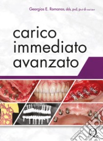 Carico immediato avanzato libro di Romanos Georgios E.