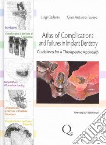 Atlas of complications and failures in implant dentistry. Guidelines for a therapeutic approach libro di Galasso Luigi; Favero Gian Antonio