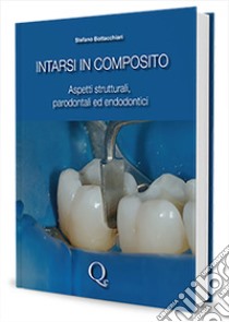 Intarsi in composito. Aspetti strutturali, parodontali ed endodontici libro di Bottacchiari Stefano