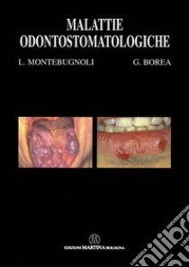 Malattie odontostomatologiche libro di Montebugnoli Lucio; Borea Giorgio