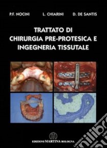 Trattato di chirurgia pre-protesica e ingegneria tissutale libro di Nocini P. Francesco; Chiarini L.; De Santis D.