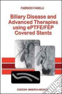 Biliary disease and advanced therapises using ePTFE/FEP covered stents libro di Fanelli Filippo