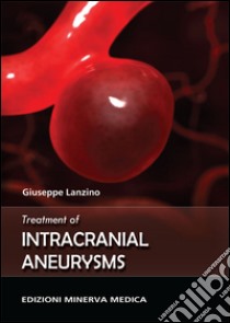 Treatment of intracranial aneurysms libro di Lanzino Giuseppe