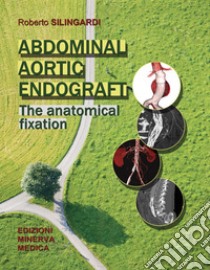 Abdominal aortic endograft. The anatomical fixation libro di Silingardi Roberto