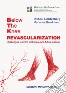 Below the knee revascularization. Challenges, current technique and future outlook libro di Lichtenberg Michael; Brodmann Marianne