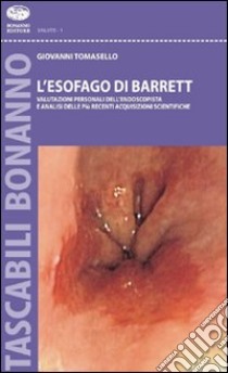 L'Esofago di Barrett. Valutazioni personali dell'endoscopista e analisi sulle più recenti acquisizioni scientifiche libro di Tomasello Giovanni