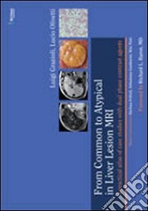 From common to atypical in liver lesion MRI. A practical atlas of case studies with dual phase contrast agents libro di Grazioli Luigi; Olivetti Lucio