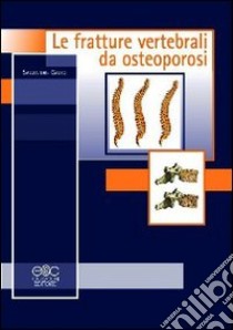Le fratture vertebrali da osteoporosi libro di Gatto Salvatore