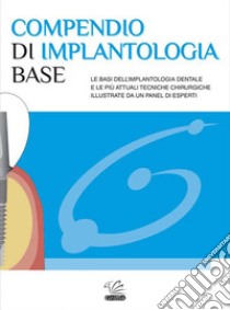 Compendio di implantologia base libro di Russo Andrea