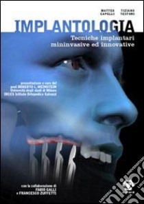 Implantologia. Tecniche implantari mininvasive e innovative libro di Capelli Matteo; Testori Tiziano; Indelli P. (cur.)