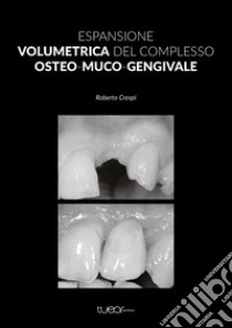 Espansione volumetrica del complesso osteo-muco-gengivale libro di Crespi Roberto