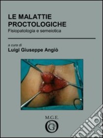 Le malattie proctologiche. Fisiopatologia e semeiotica libro di Angiò Luigi G.