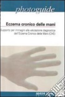 Eczema cronico delle mani. Supporto per immagini alla valutazione diagnostica dell'eczema cronico delle mani libro di Uleri S. (cur.)