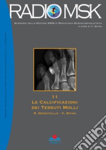 Le calcificazioni dei tessuti molli. Ediz. illustrata libro di Donatiello Salvatore; Spina Vincenzo