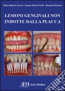 Lesioni gengivali non indotte dalla placca libro di Grassi Felice Roberto; Nardi Gianna Maria; Petruzzi Massimo