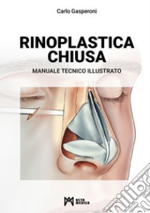 Rinoplastica chiusa. Manuale tecnico illustrato libro di Gasperoni Carlo; Oggianu L. (cur.); Roccucci G. (cur.)