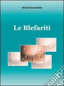 Le blefariti libro di Prescosolido Nicola