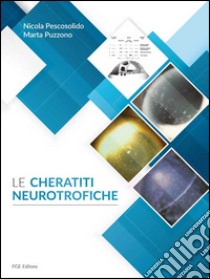 Le cheratiti neurotrofiche libro di Pescosolido Nicola; Puzzono Marta