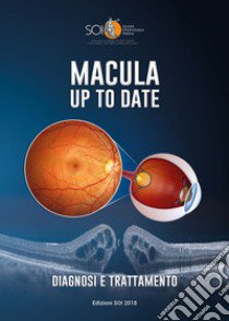 Macula up to date. Diagnosi e trattamento. Ediz. per la scuola libro di Società oftalmologica italiana (cur.)