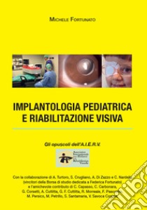 Implantologia pediatrica e riabilitazione visiva libro di Fortunato Michele